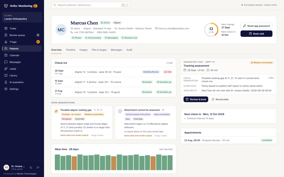 Patient profile in Ortho Monitoring AI with aligner 12 of 30, check-in history, AI observations for review, a wear time chart and a suggested tracking assessment visit